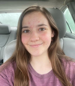 Fundraising Page Image